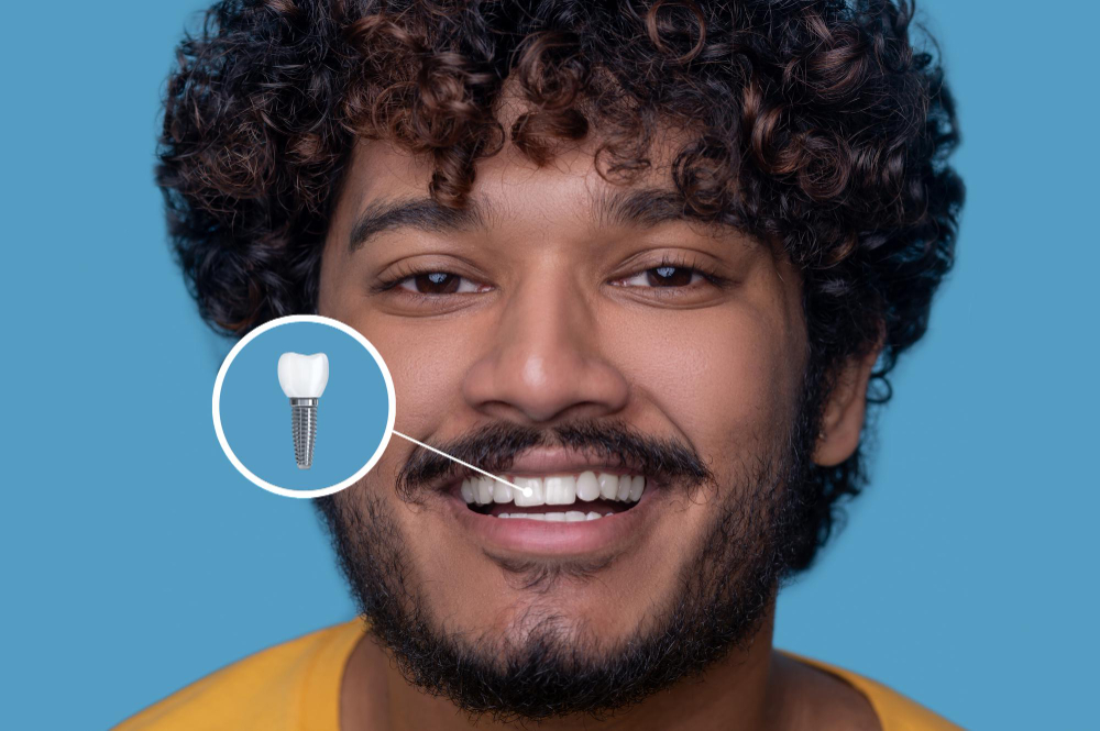 Dental Implants in Indirapuram | White Dental Healthcare