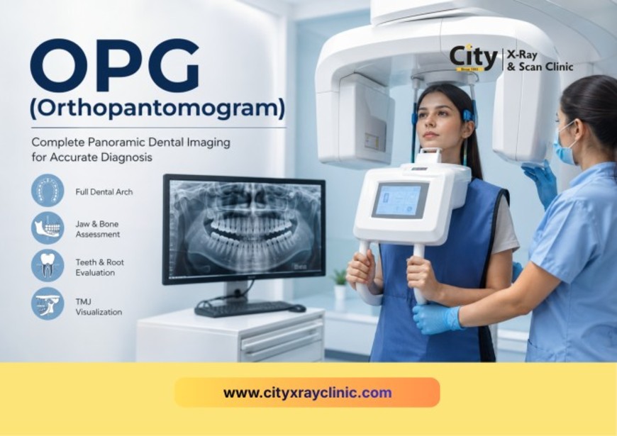 OPG (Orthopantomogram) – Panoramic Dental X-Ray
