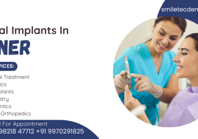 Dental-implants-in-Baner